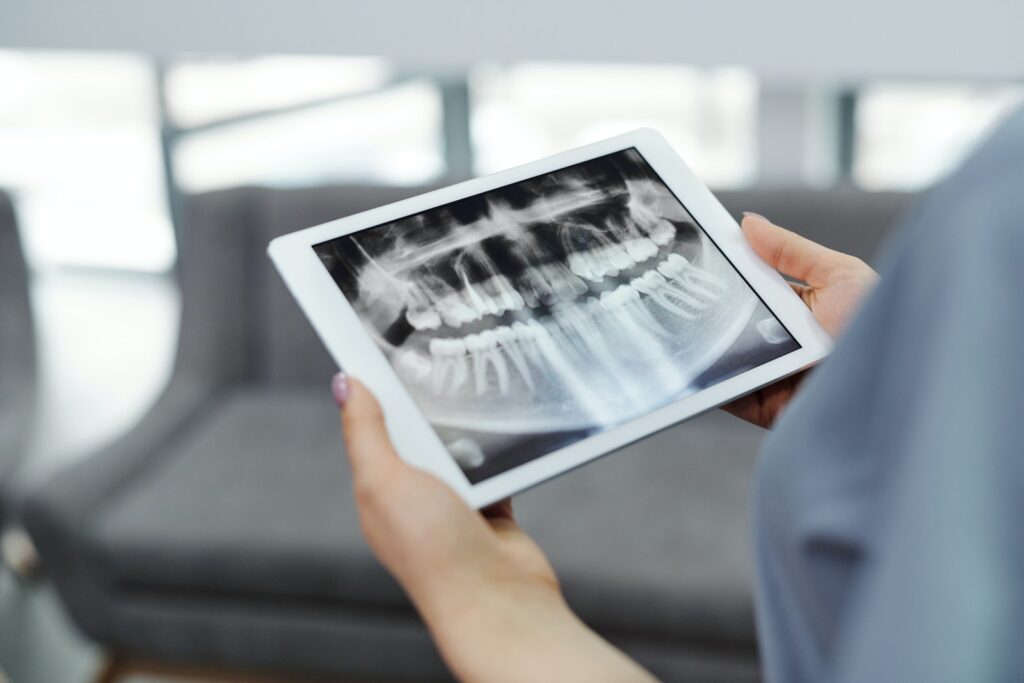 A Tablet with a Dental X-ray